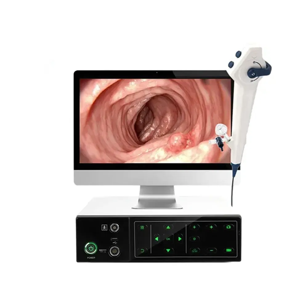 Xbx Medical Machine Manufacturers Diagnosis Equipment Supplier Multi-Functional Desktop Endoscope Host