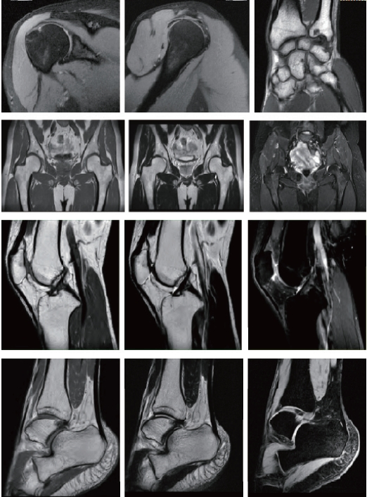 Ummri121 Liquid Helium-Free Superconducting MRI System