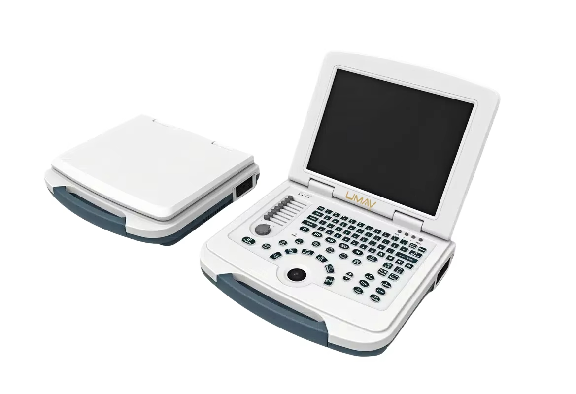 Color Ultrasound Device for Diagnostic Imaging in Obstetric Medical Centers