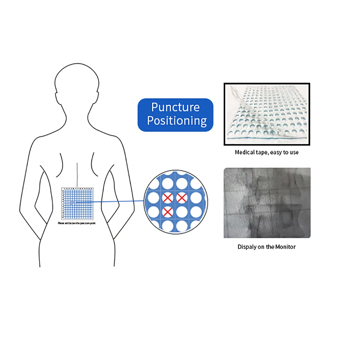 Disposable Non-Woven Surgical Use Sterile CT Biopsy Grid for X-ray Inspection