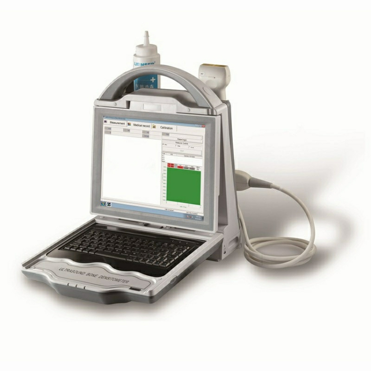Portable Laptop Digital Automatic Ultrasound Bone Densitometer