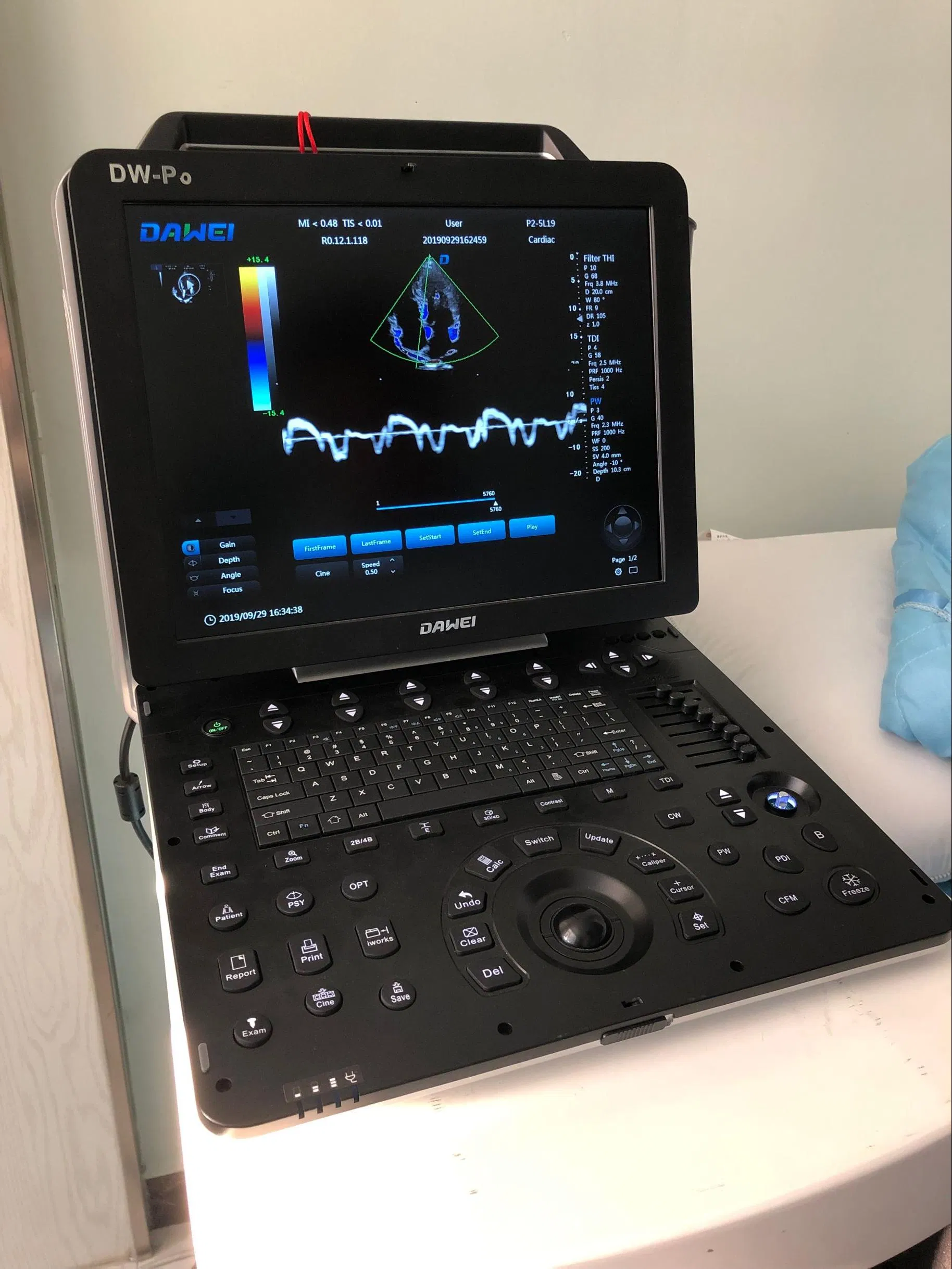 Point of Care Laptop Ultrasound Color Doppler Scanner