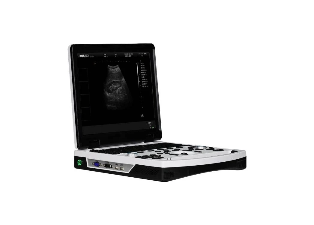 Point of Care Black and White Ultrasound with Battery