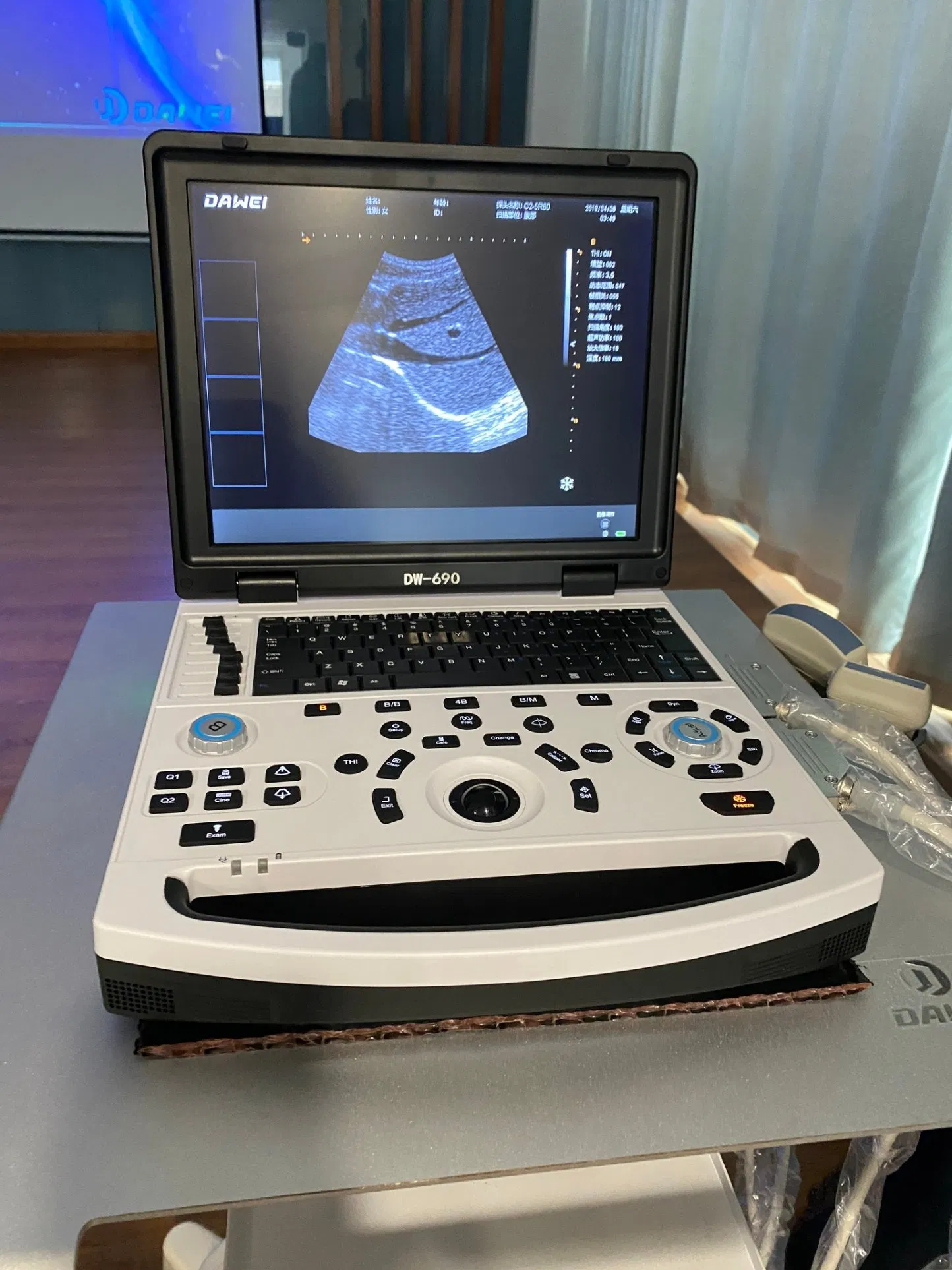 Point of Care Black and White Ultrasound with Battery