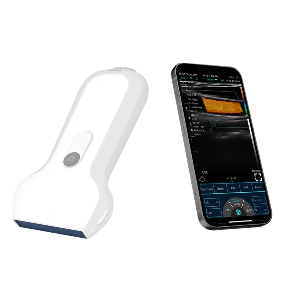 Handheld Ultrasound View 2