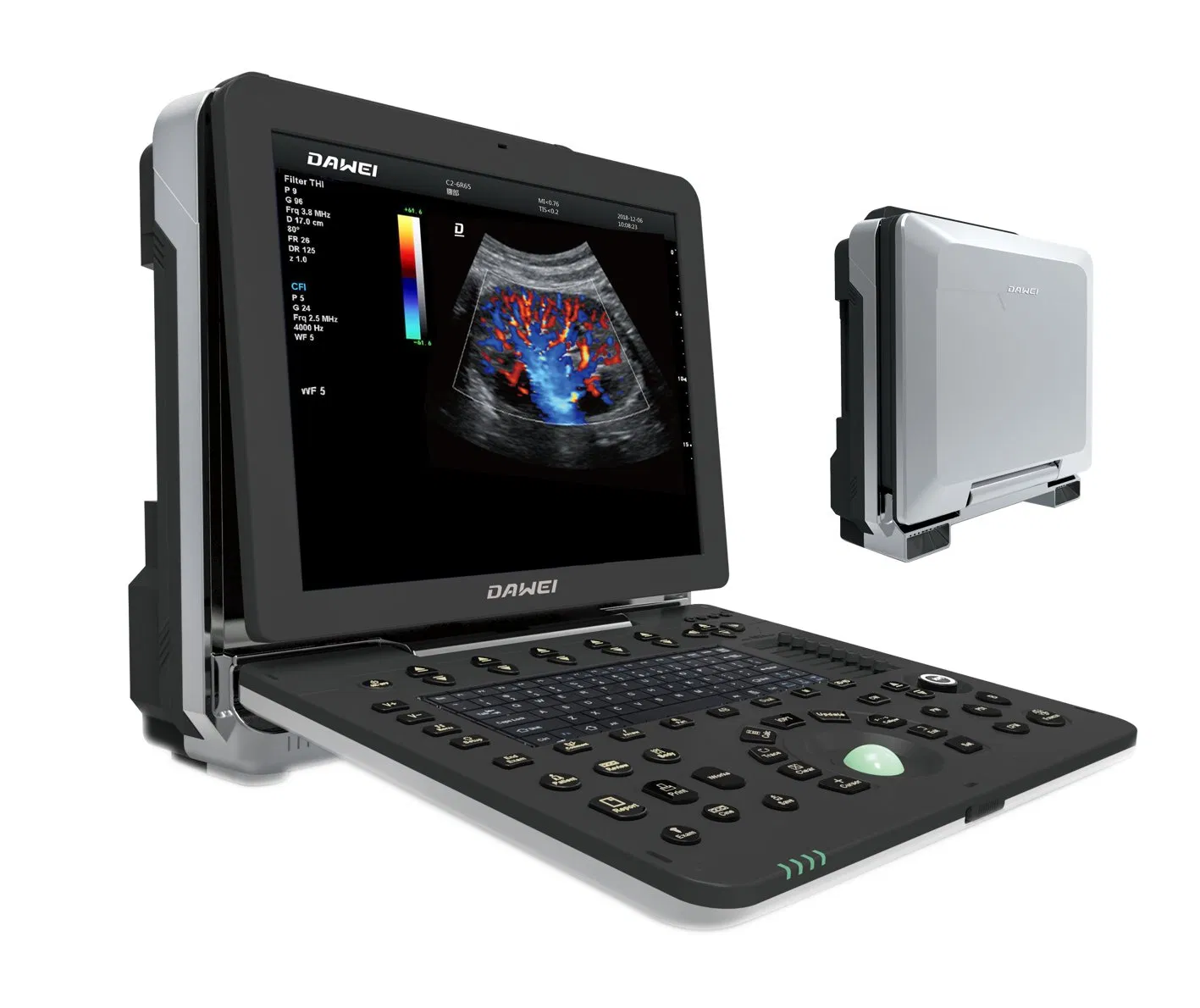 Point of Care Laptop Ultrasound Color Doppler Scanner