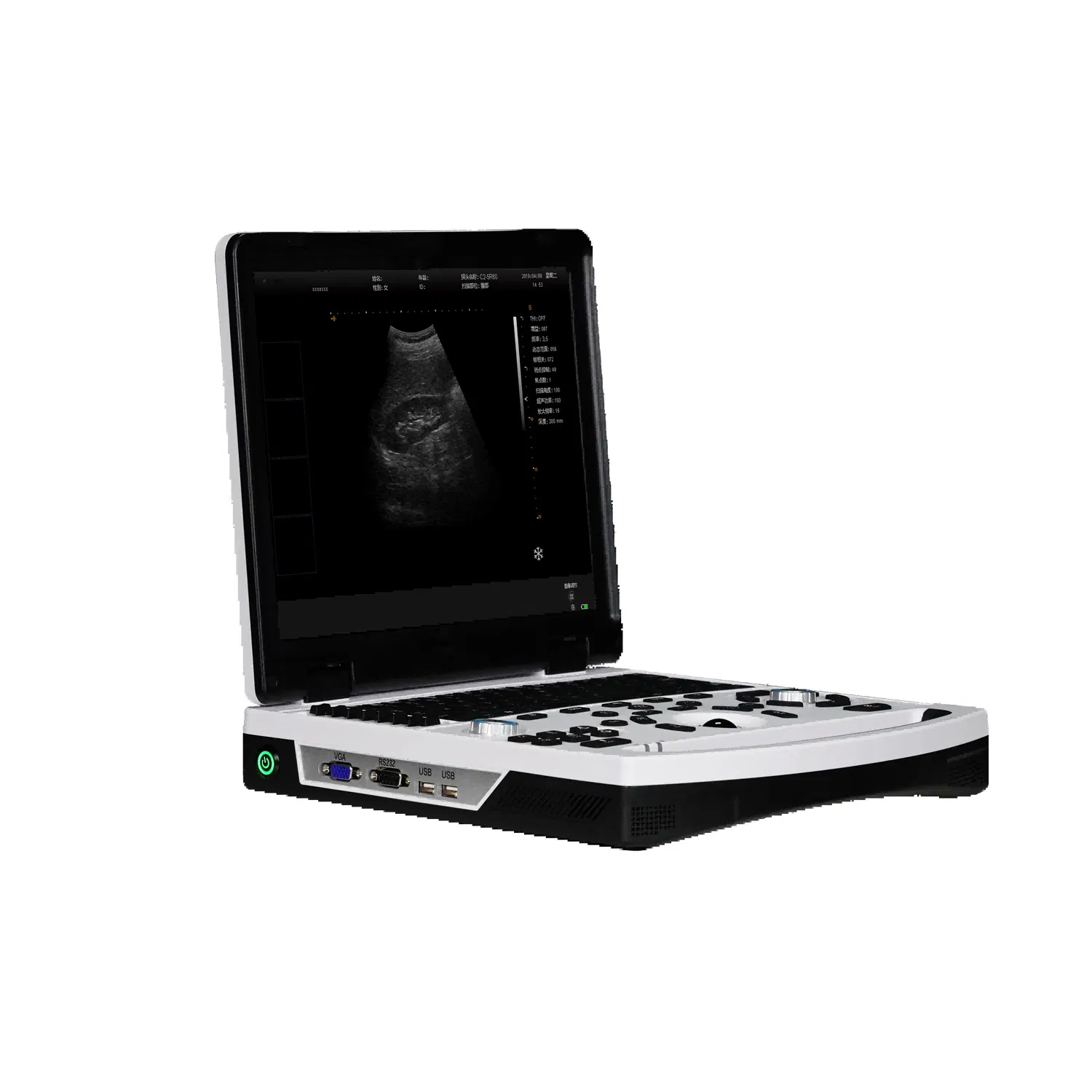 MT-690 Laptop Ultrasound Scanner