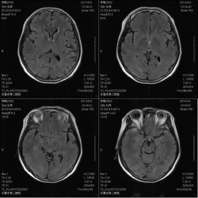 High Quality 1.5t Magnetic Resonance Imaging Radiology Equipment Price Medical MRI Equipments
