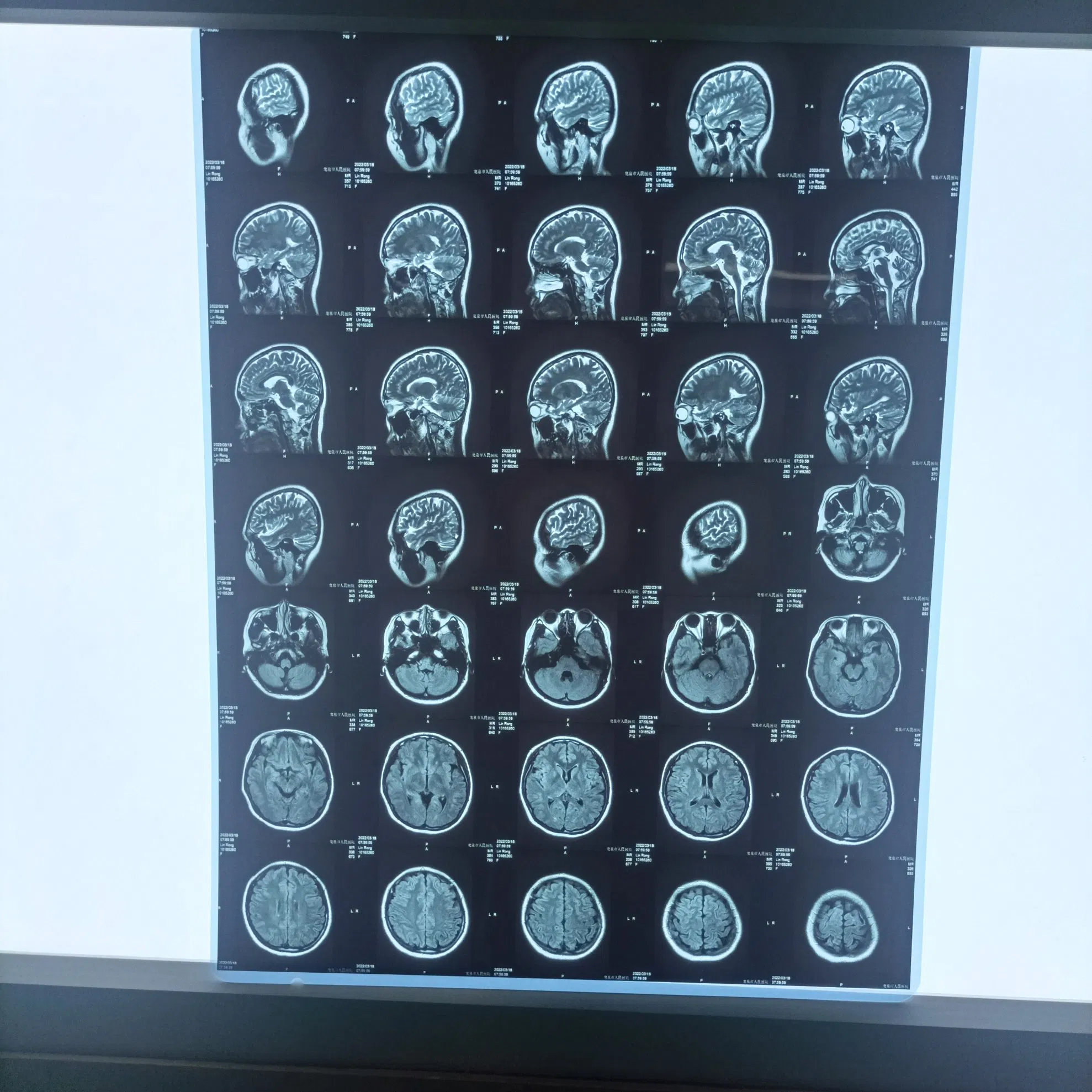 Integrated Medical Inkjet Printing System for Versatile CT, Cr, and Dr Diagnostic Applications