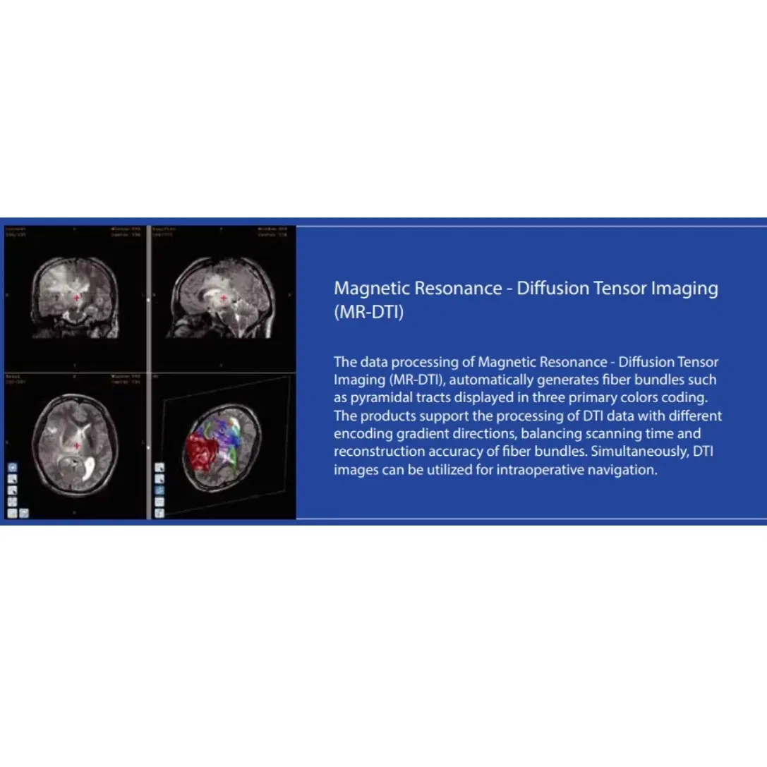 Neurosurgery Operation Neurosurgical System Medical Equipment Medical Supply