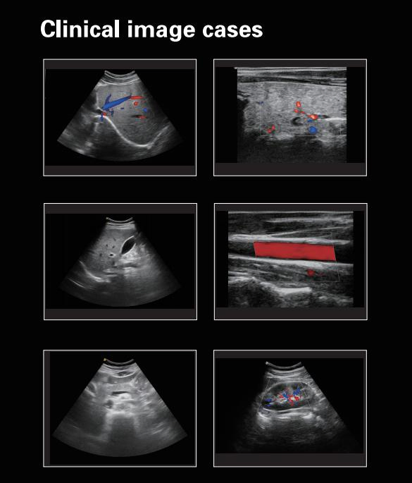 Point-of-Care Ultrasound Scanners for ICU Use