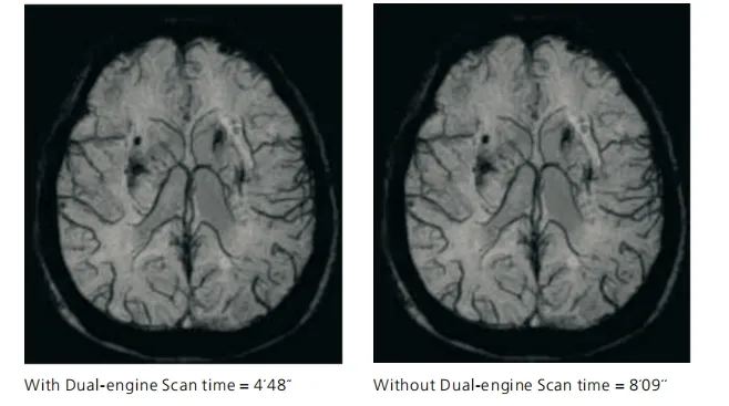 Parallel acquisition technology