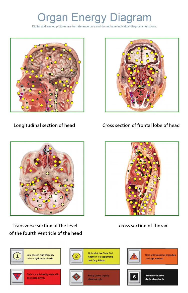 MRI System Visual