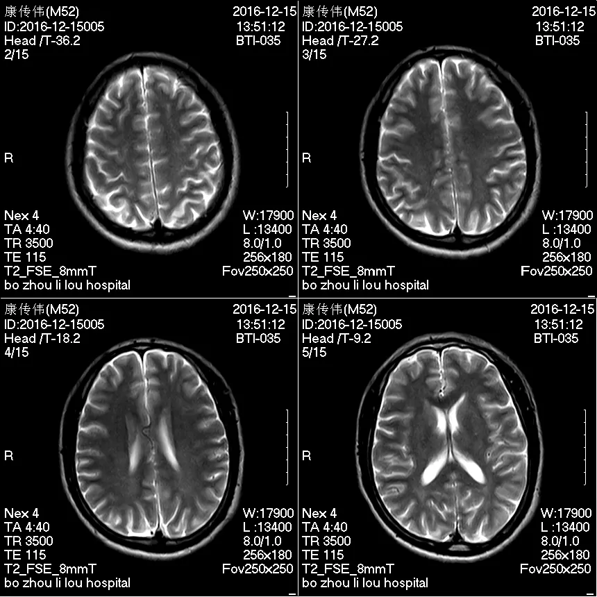 Supermark 1.5t MRI System 1
