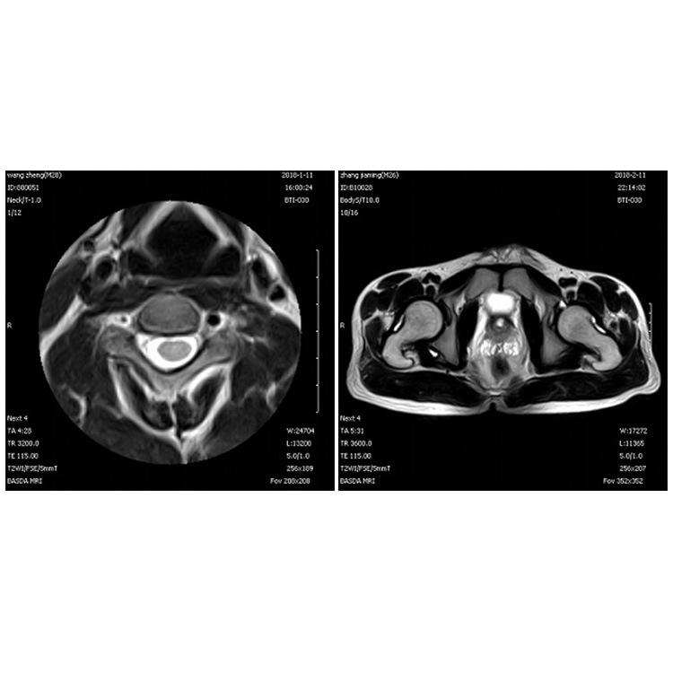 Xmr020 Medical Comprehensive Scanning Sequence Permanent Extremity MRI Scanners