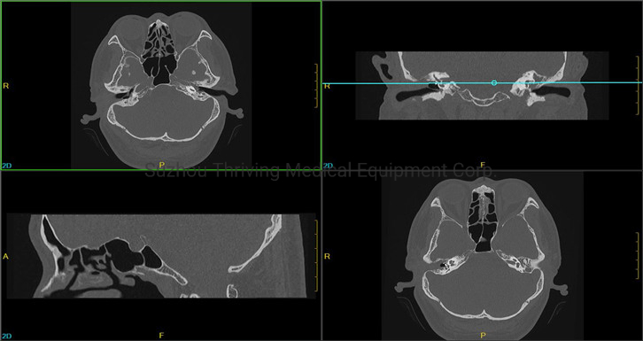 CT Scan Machine Radiology Equipment Imaging Scanner Medical MRI 32 Slice CT Scanner