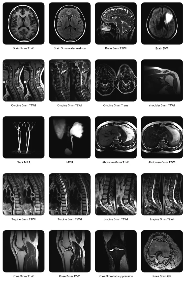 MRI Equipment Detail