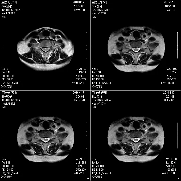 Supermark 1.5t MRI System 3