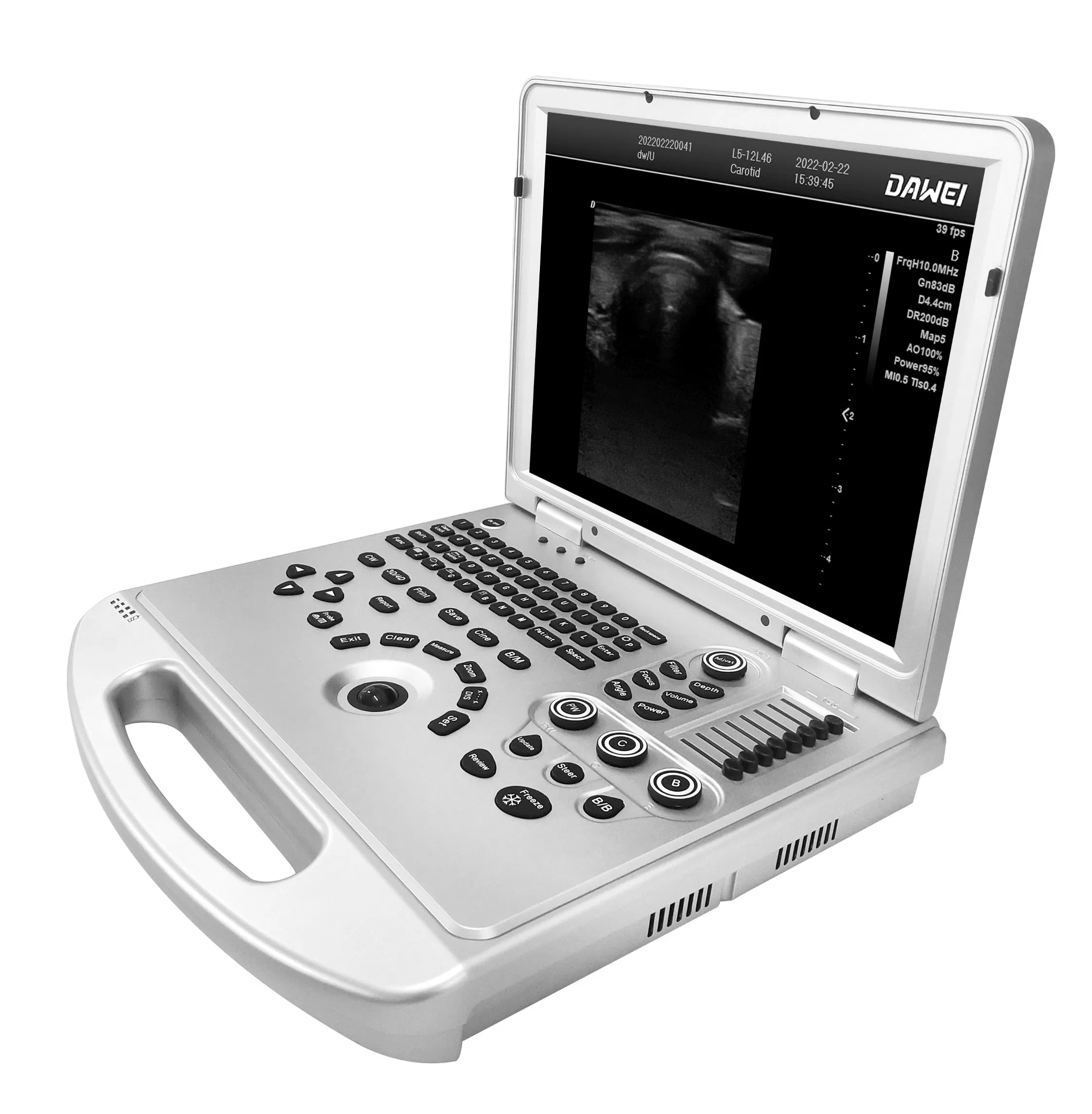 Point-of-Care Ultrasound Scanners for ICU Use