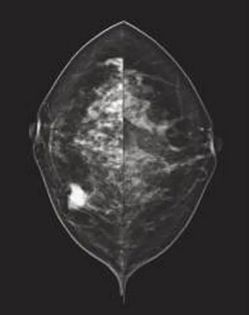 Cutting-Edge MRI System with Customizable Features for Enhanced Patient Care