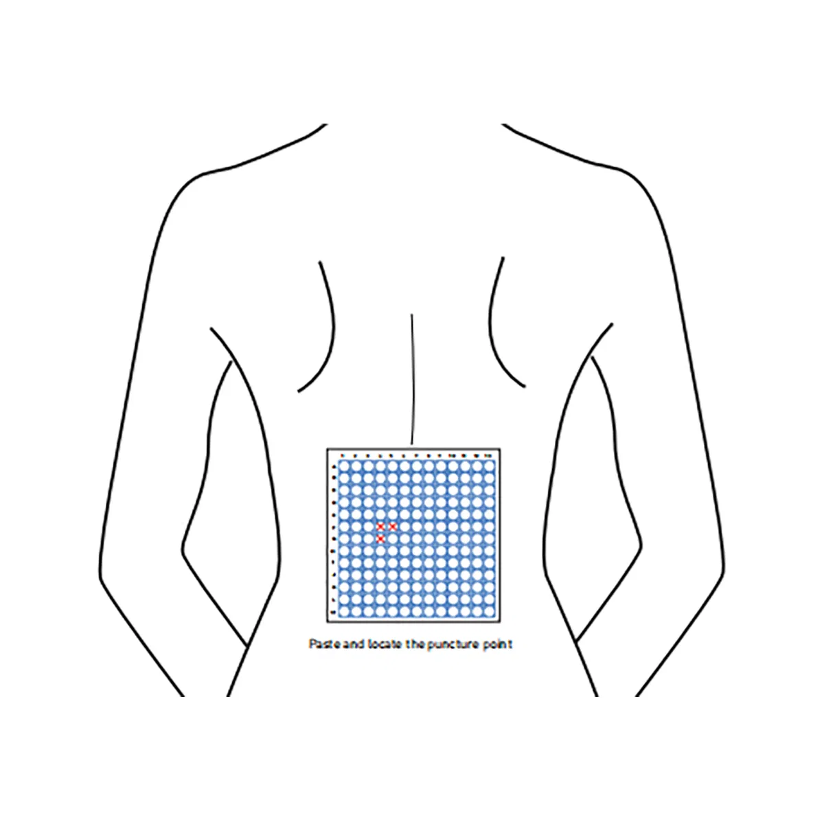 Disposable Medical Radiolucent CT Biopsy Grid for Accurate Needle Guidance