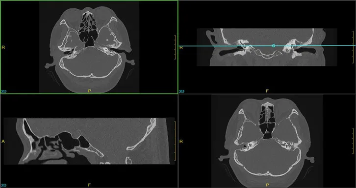 Clinical Image Analysis