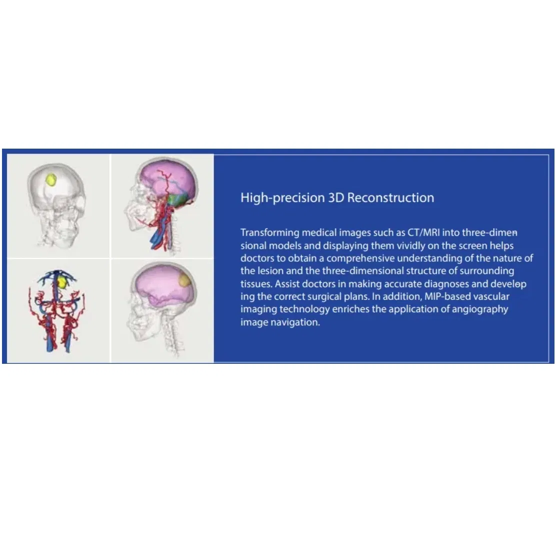 Neurosurgery Medical Supply Neurosurgical System Medical Equipment for Neurosurgery