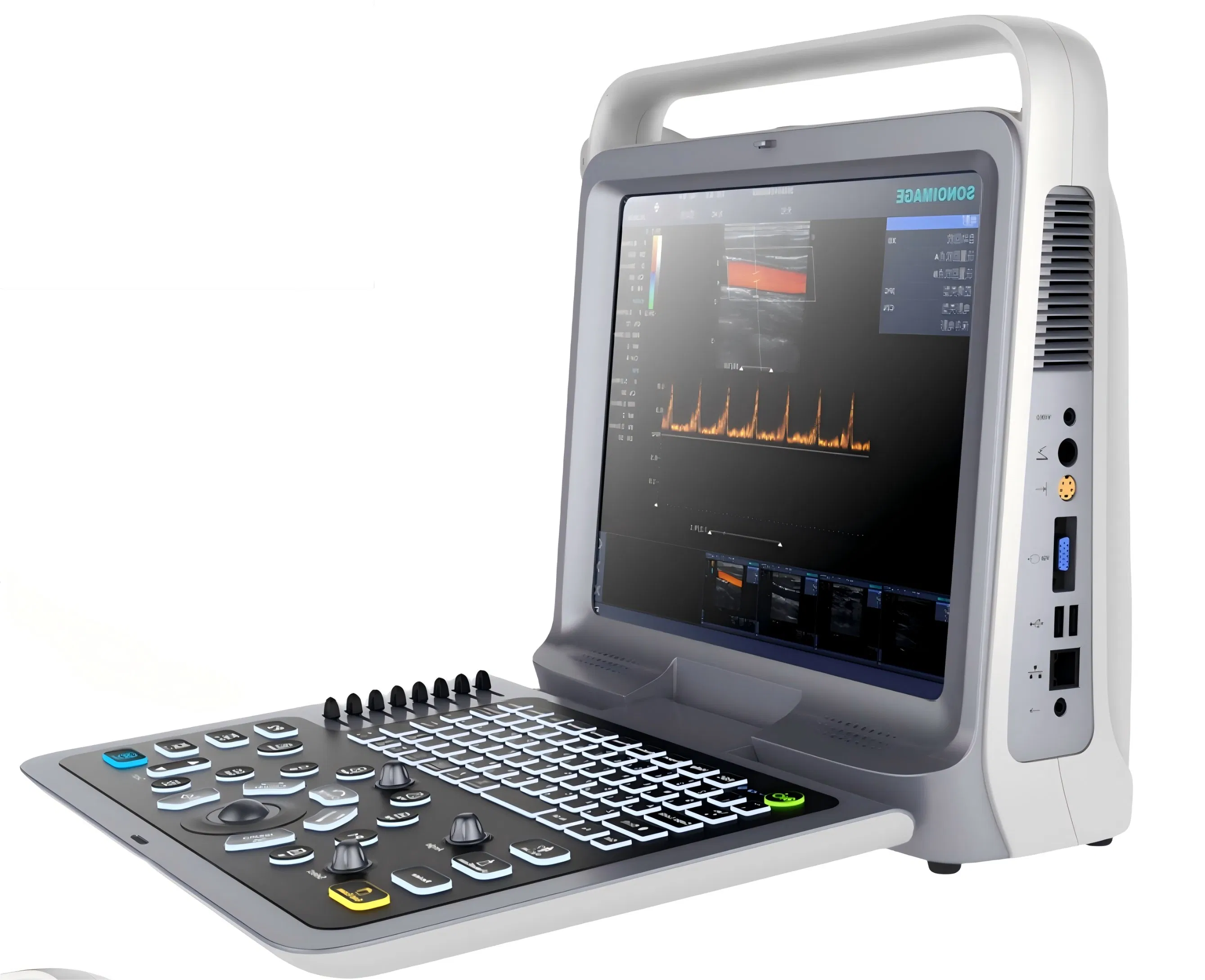 Portable Color Doppler Handheld Ultrasound Scanner Diagnostic System with High Frequency Probes for Emergency Room Point of Care and Remote Clinic Applications