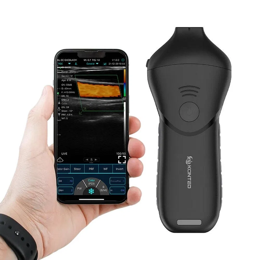 Handheld Innovative High-Definition Ultrasound Scanner Probe for Point-of-Care Emergency Exams