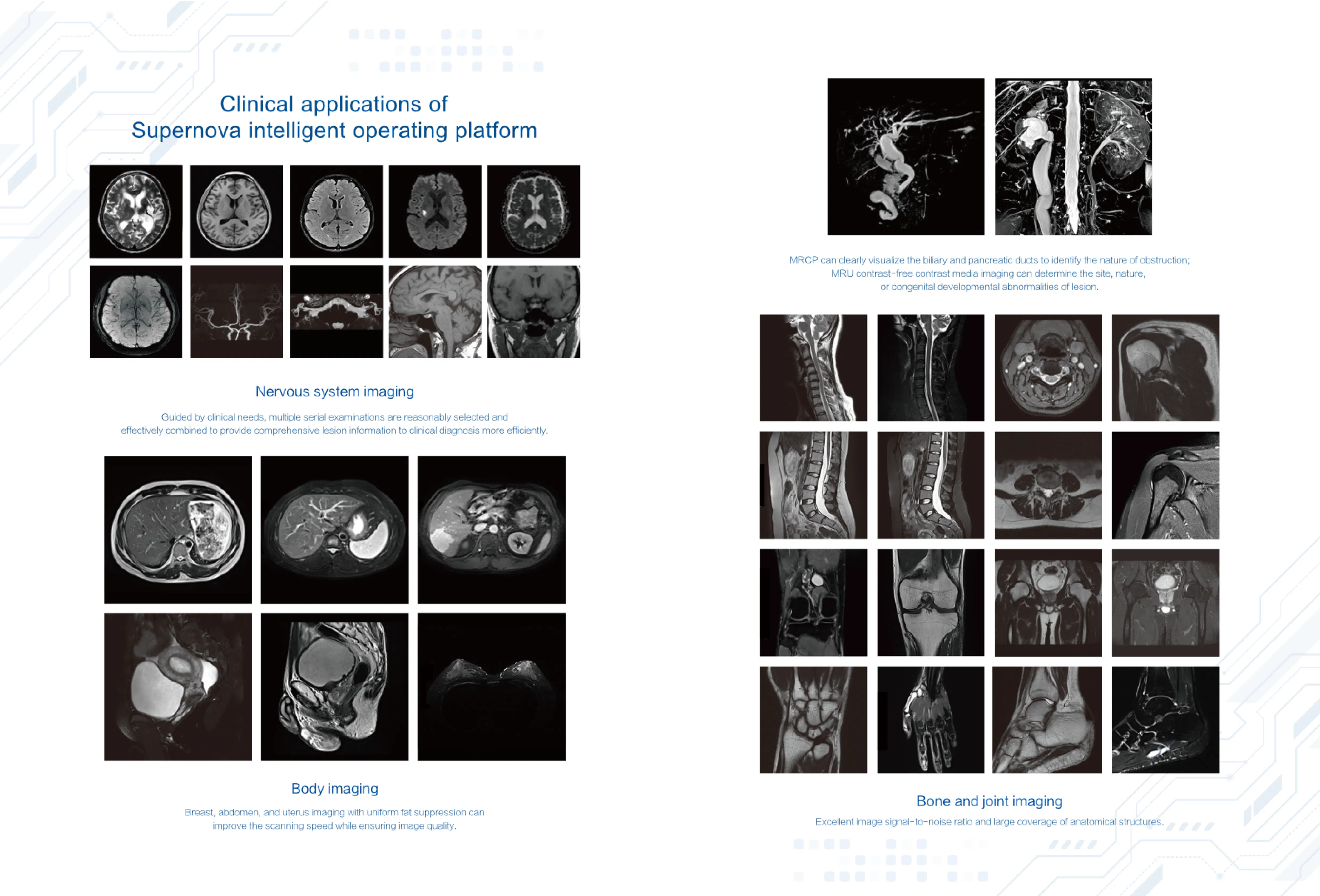 Advanced MRI Scanner and Machine for Enhanced Imaging Capabilities