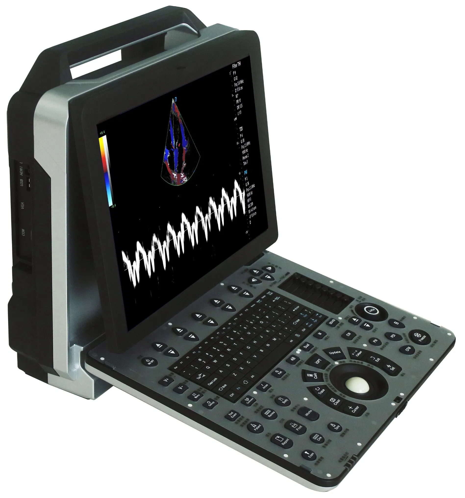 Point of Care Laptop Ultrasound Color Doppler Scanner