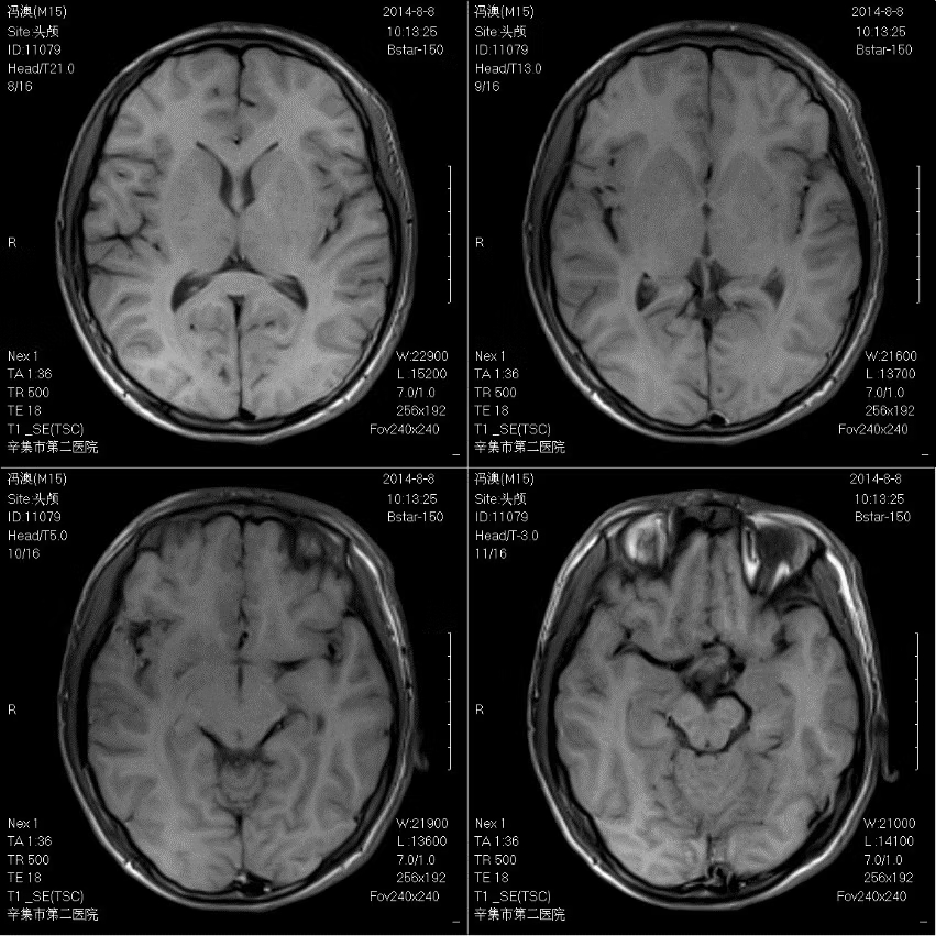 Medical MRI Machines