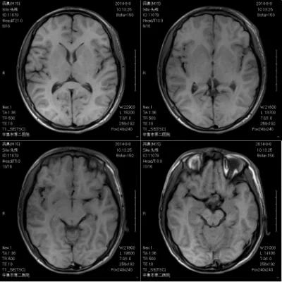 Hot Sale 1.5t Hospital Imaging Magnetic Resonance Radiology Medical Equipment MRI Scanner