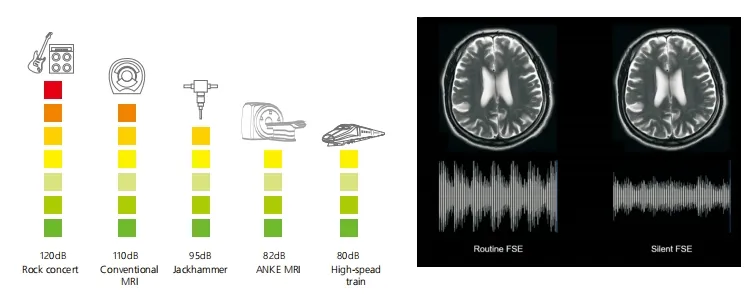 Silent Scanning Technology