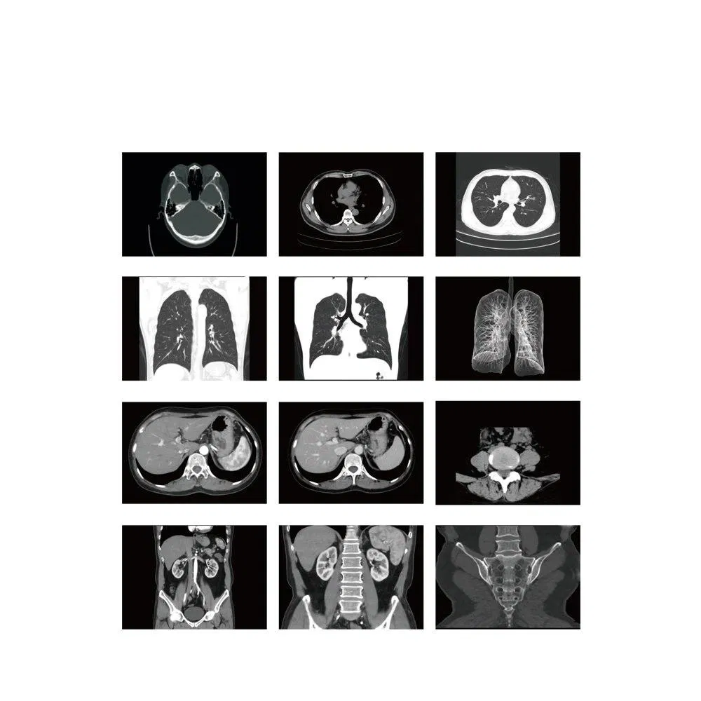 Hospital Computed Tomography Scanner MRI CT Radiologic 16 Slice Spiral Medical CT Scanner Price 16 32 64 128 Slice