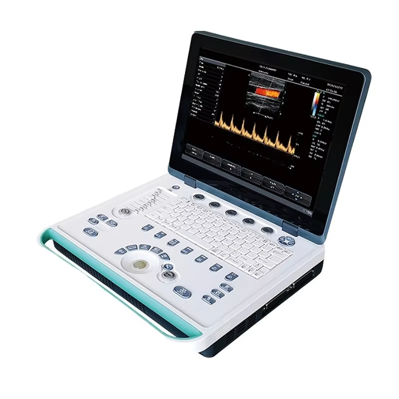 Color Ultrasound Device for Diagnostic Imaging in Obstetric Medical Centers