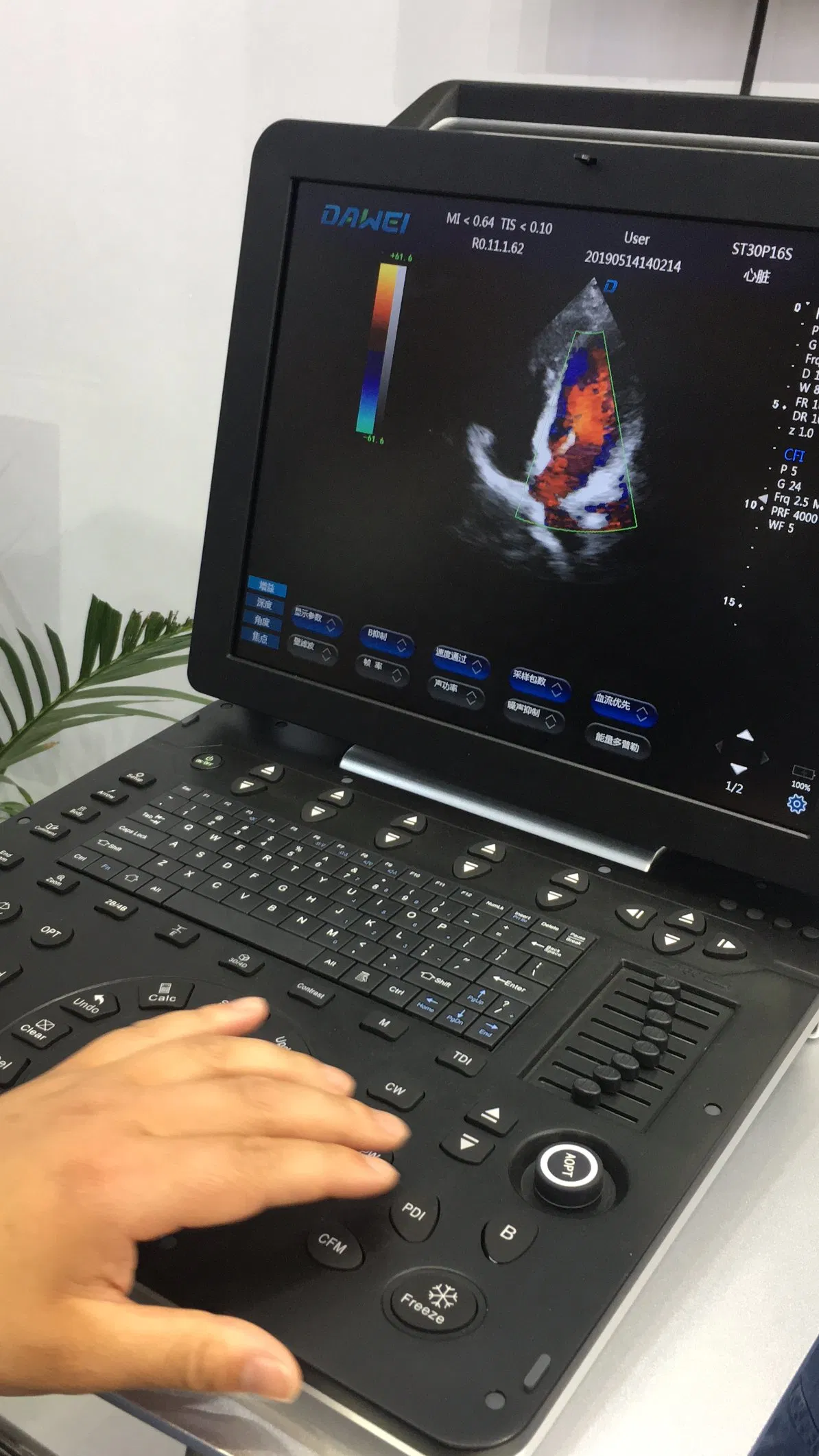 Point of Care Laptop Ultrasound Color Doppler Scanner