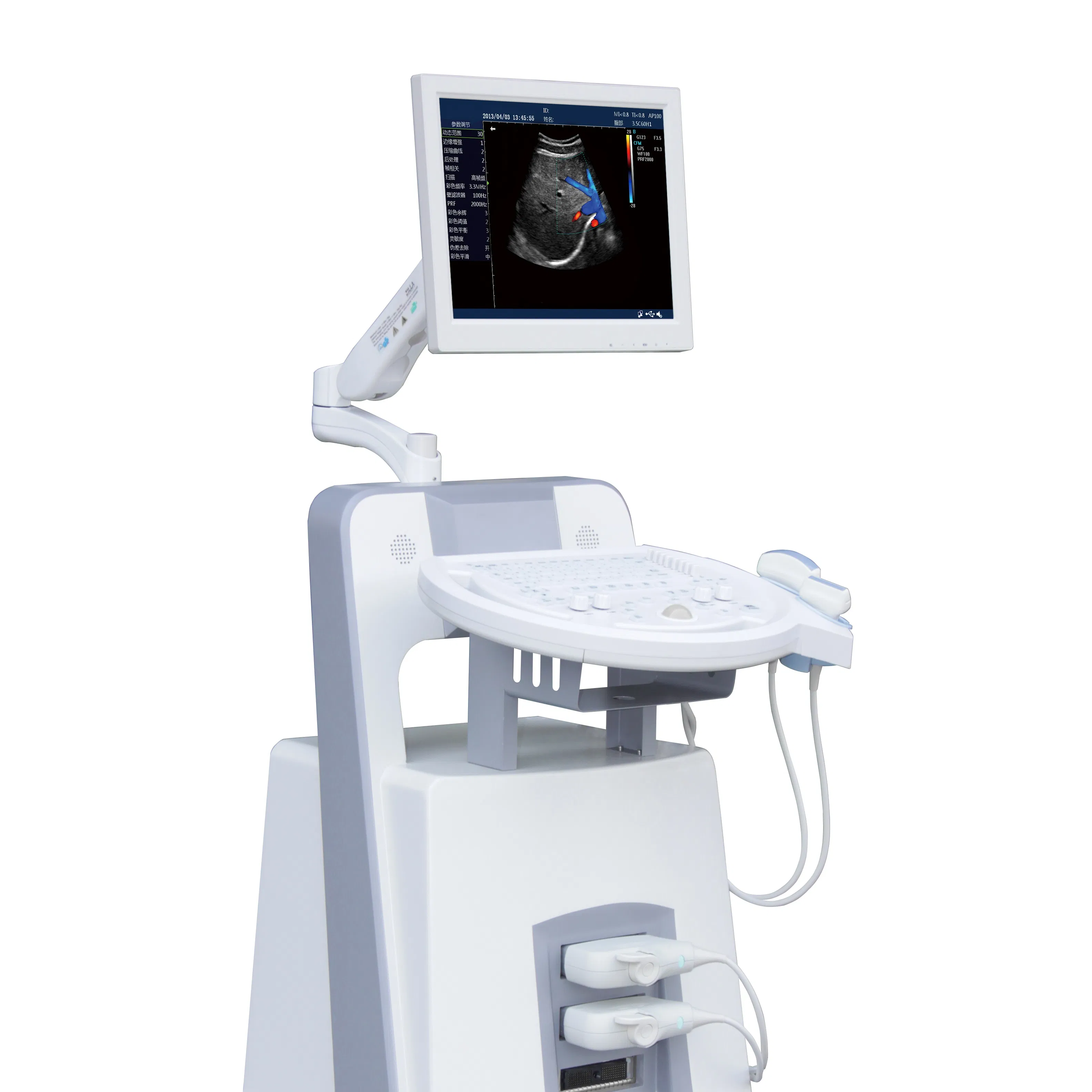 Color Ultrasound Device for Diagnostic Imaging in Obstetric Medical Centers