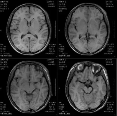 MRI Open System Machine 1.5 Pet Permanent Magnet Hospital X-ray Dr System