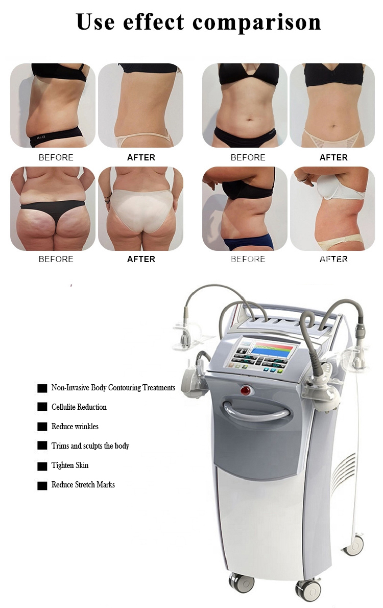 Professional 4D Venus RF Vacuum Fat Reduction Body Slimming Device Tightening Non-Invasive Contouring Machine