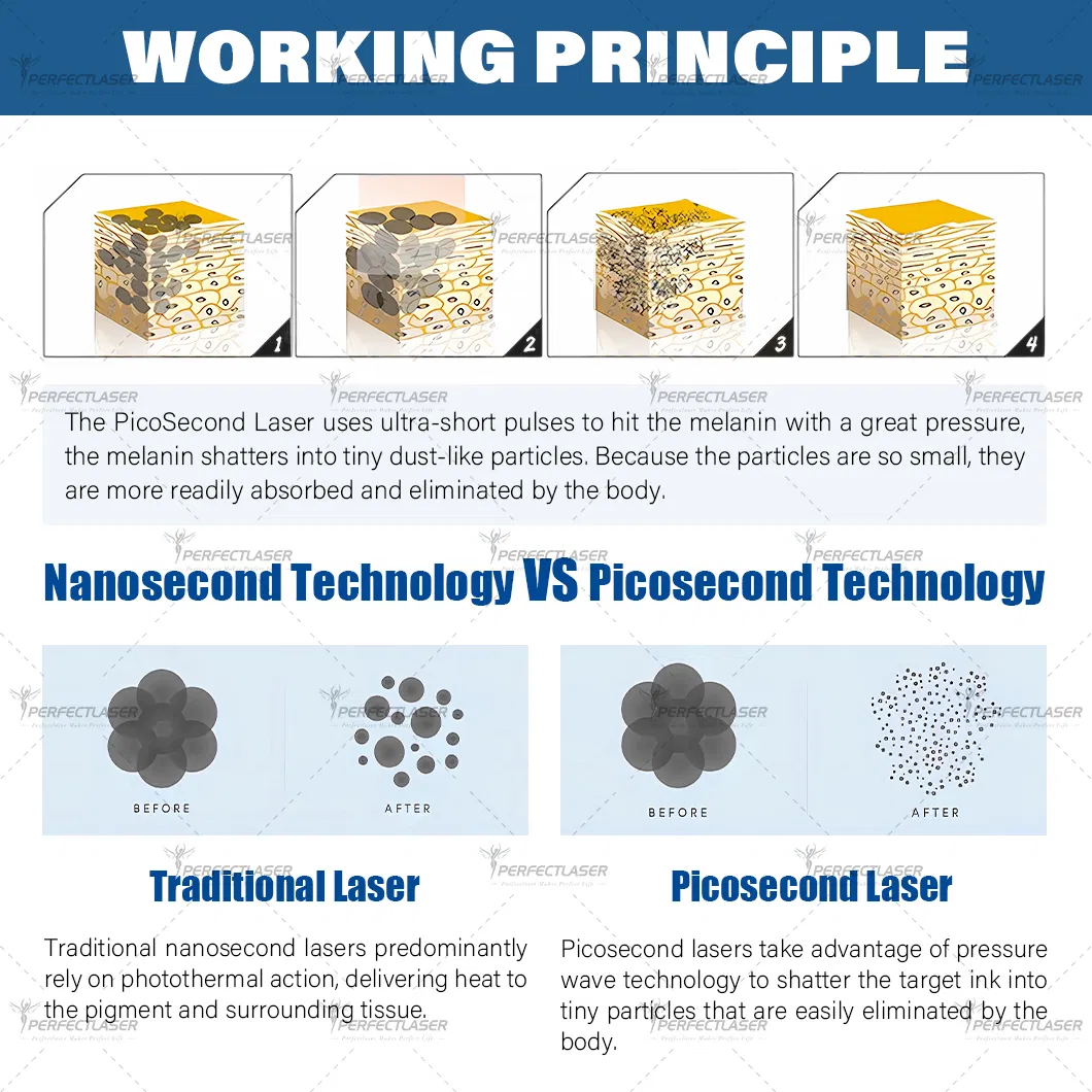 Picosecond Working Principle