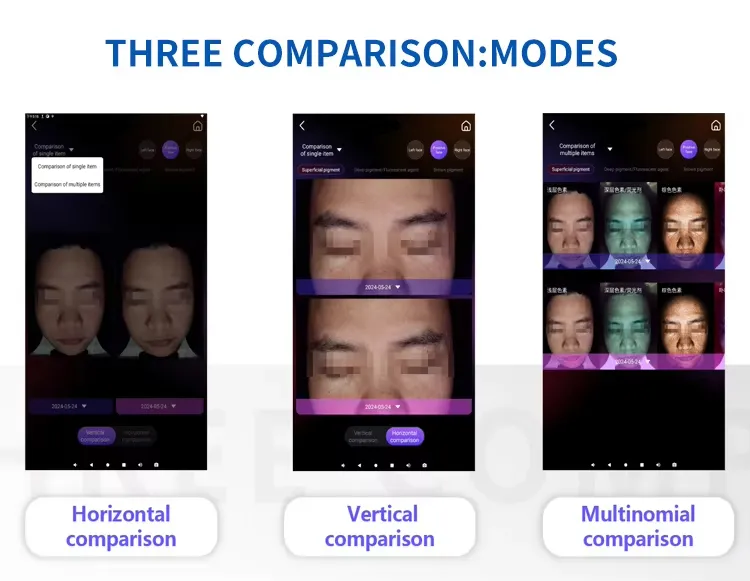 Digital Skin Analysis