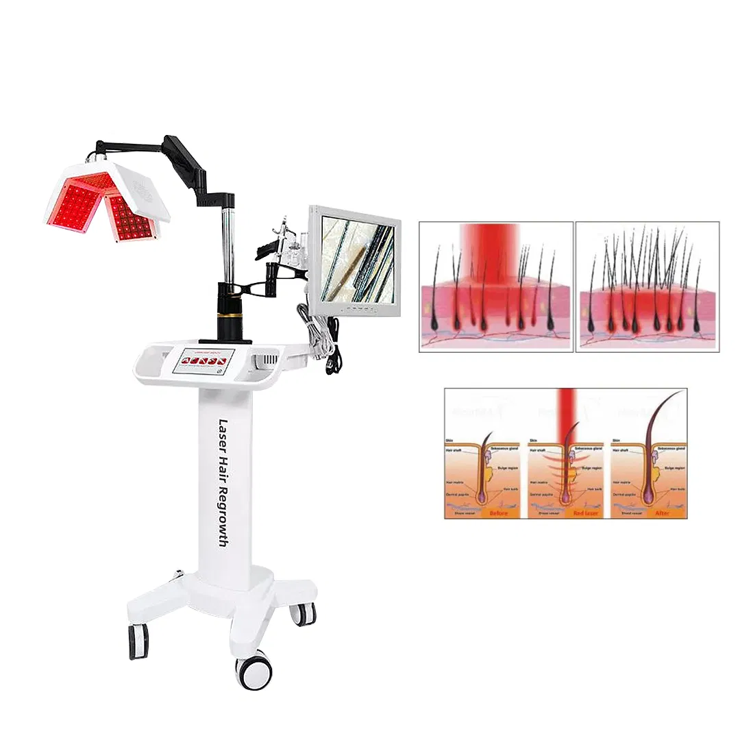 Professional Anti Hair Loss Treatment Diode Laser Hair Regrowth Machine