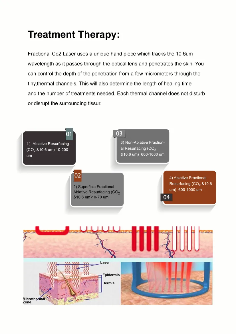 Fractional CO2 Laser Skin Resurfacing