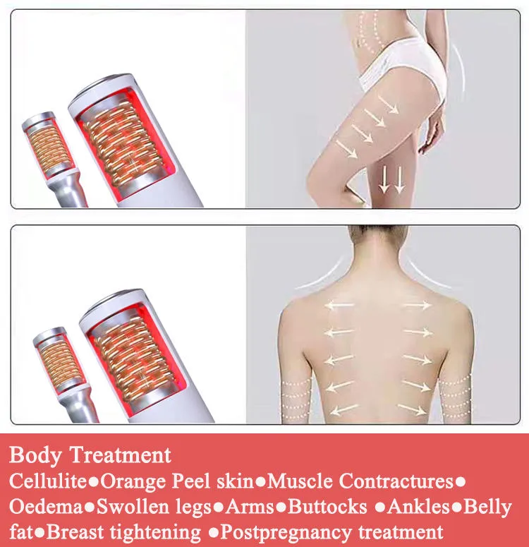 Cellulite Treatment