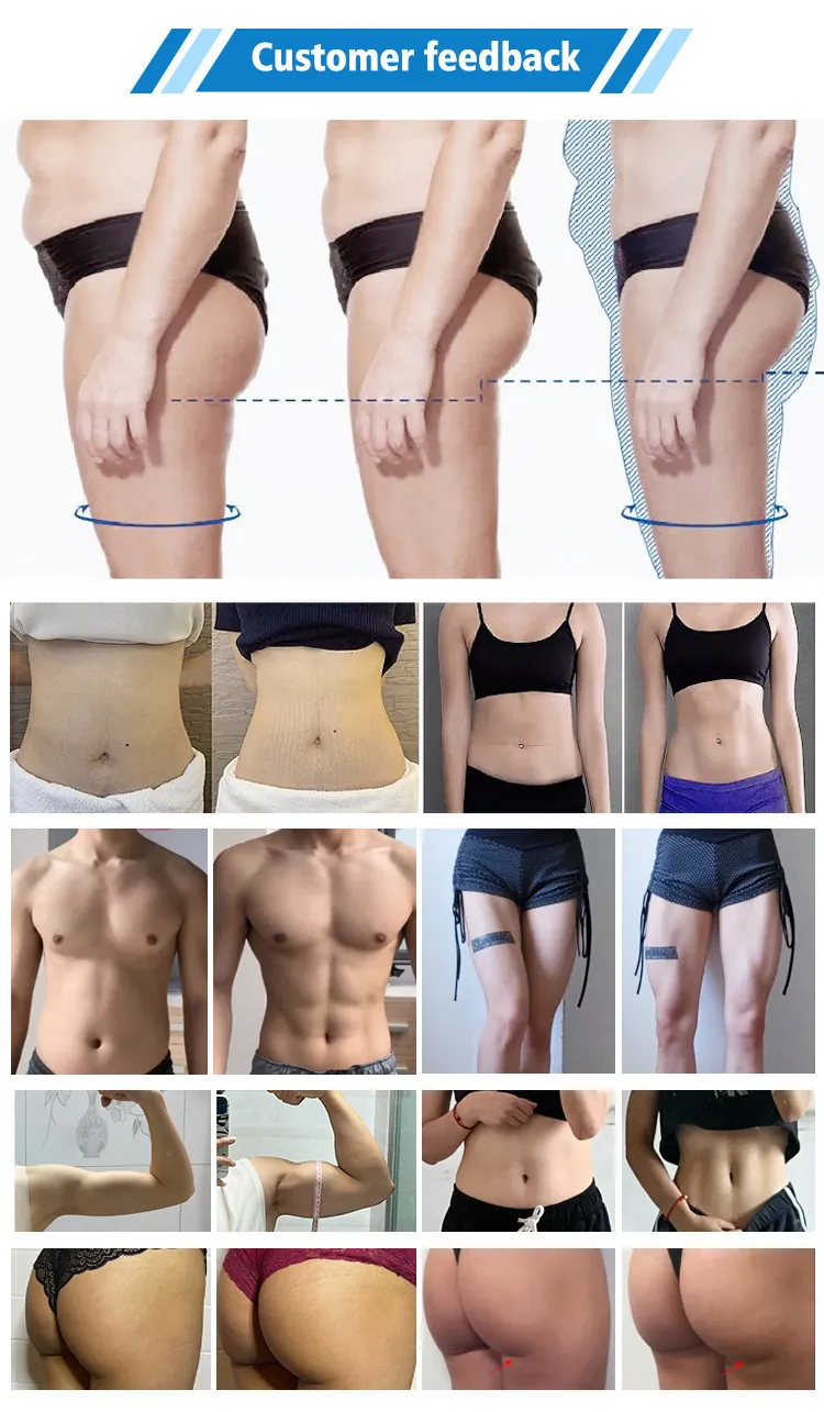 EMS Result Before After