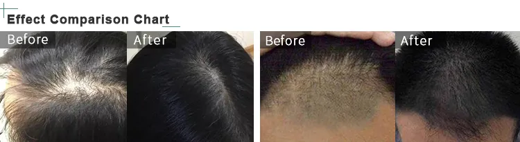 Hair Growth Scalp Effect
