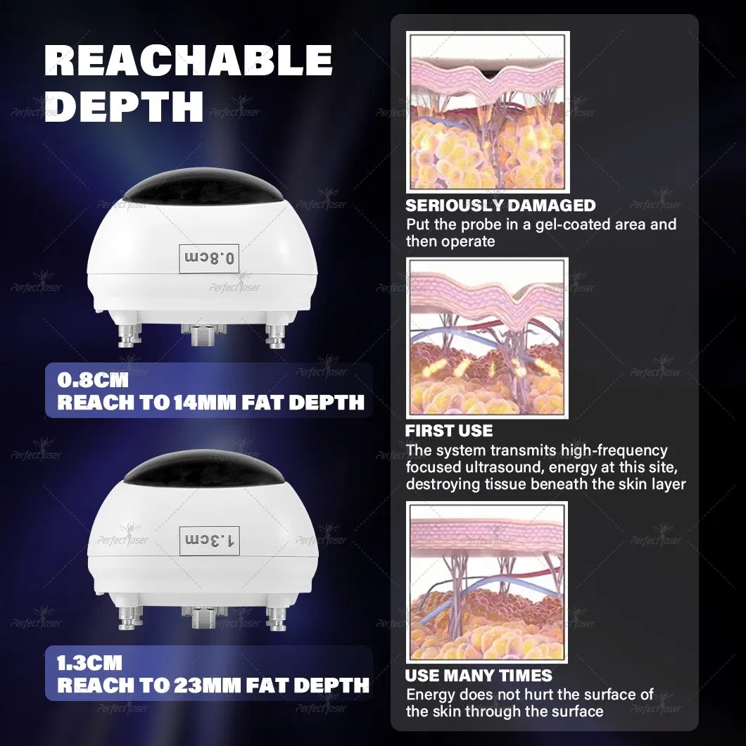 High Intensity Focused Ultrasound Face Lift Wrinkle Removal Beauty Hifu