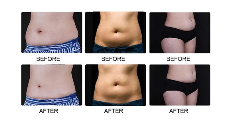 Before and After Results