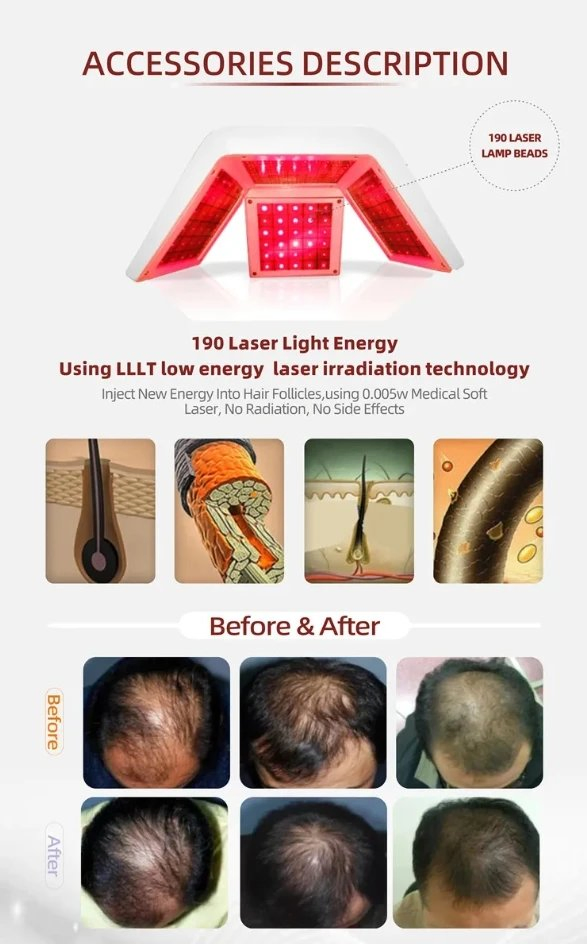 Hair Loss Treatments for Hair Growth, Men and Women Laser Hair Growth Machine Hair Follicle Detection